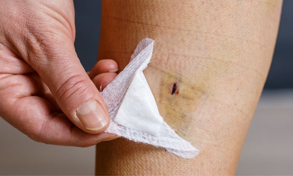 How to Prevent Infection Post-Surgery